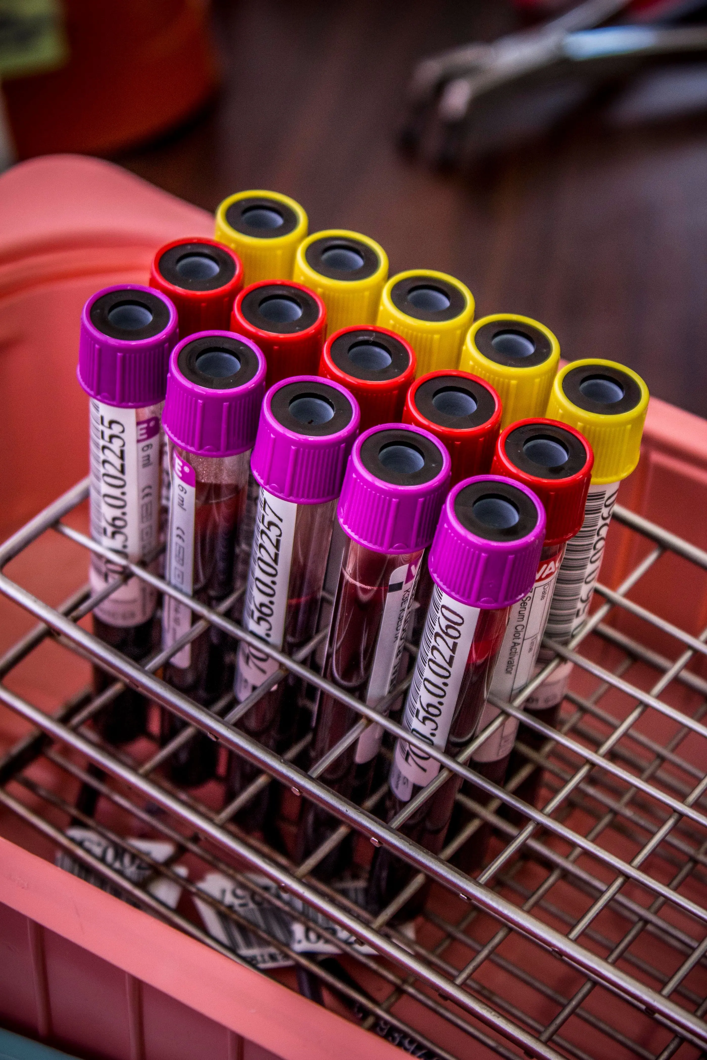 Labelled blood collection tubes racked for analysis
