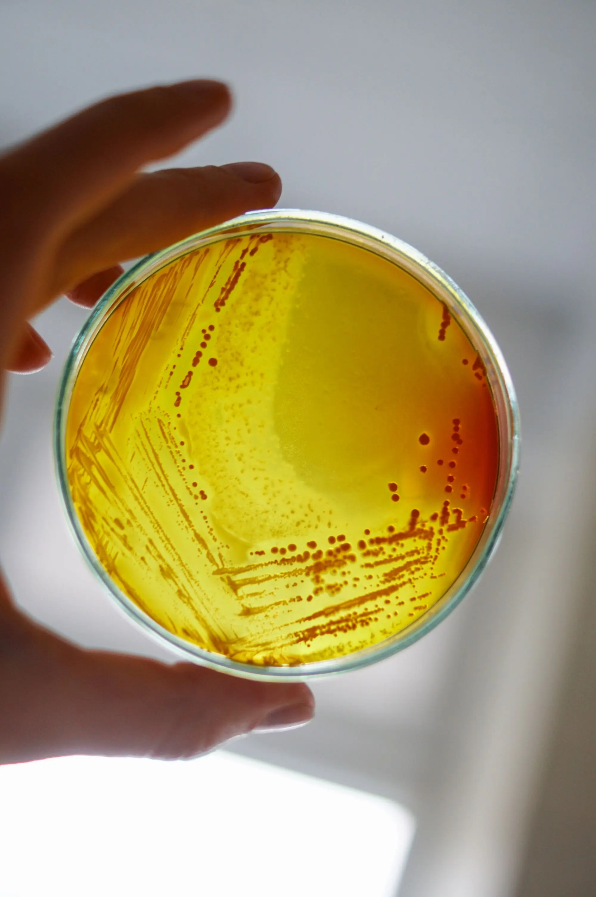 A culture plate held up under laboratory light