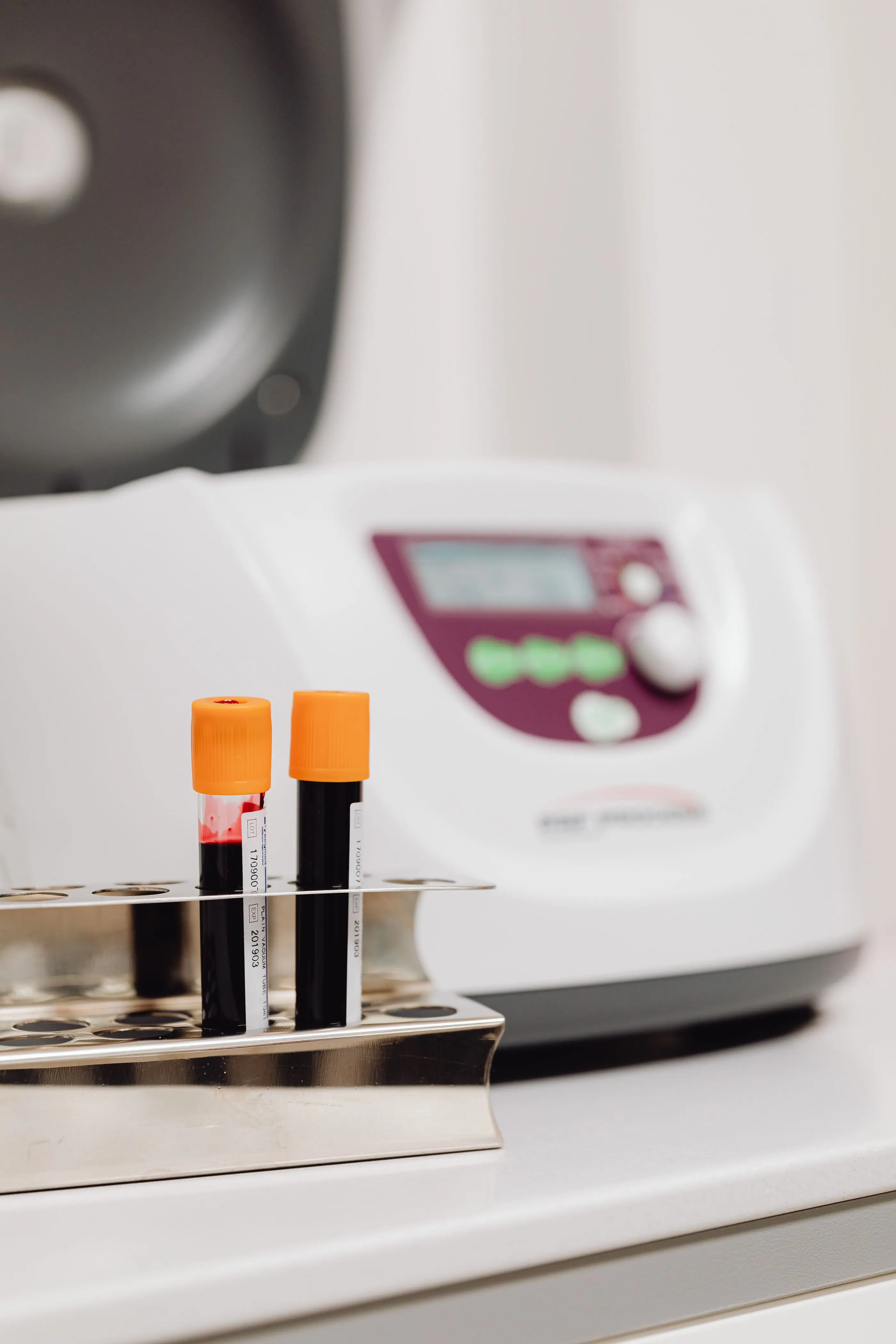 Two labelled sample tubes beside an analyser