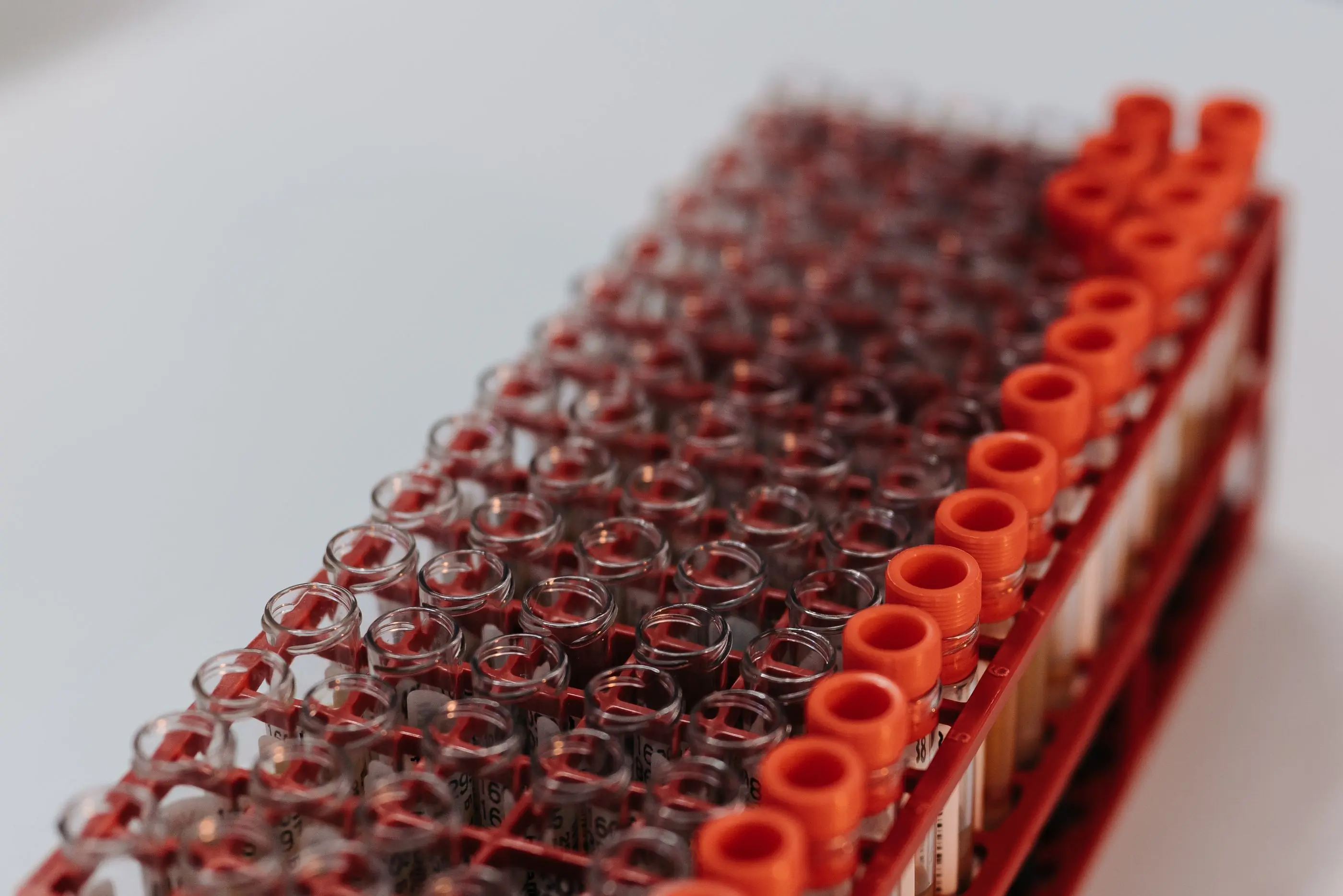 A rack of labelled blood collection tubes