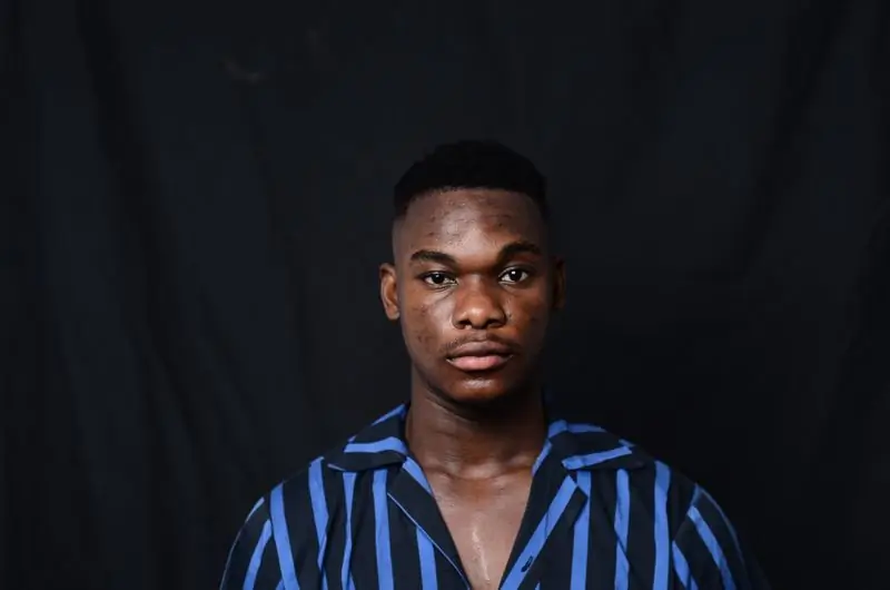 A young man in a striped open-collar shirt looking straight to camera on a black backdrop